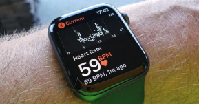 Fall Detection บน Apple Watch ช่วยชีวิตหนุ่มวัย 25 ปีที่ล้มในห้องน้ำจนกระโหลกร้าว